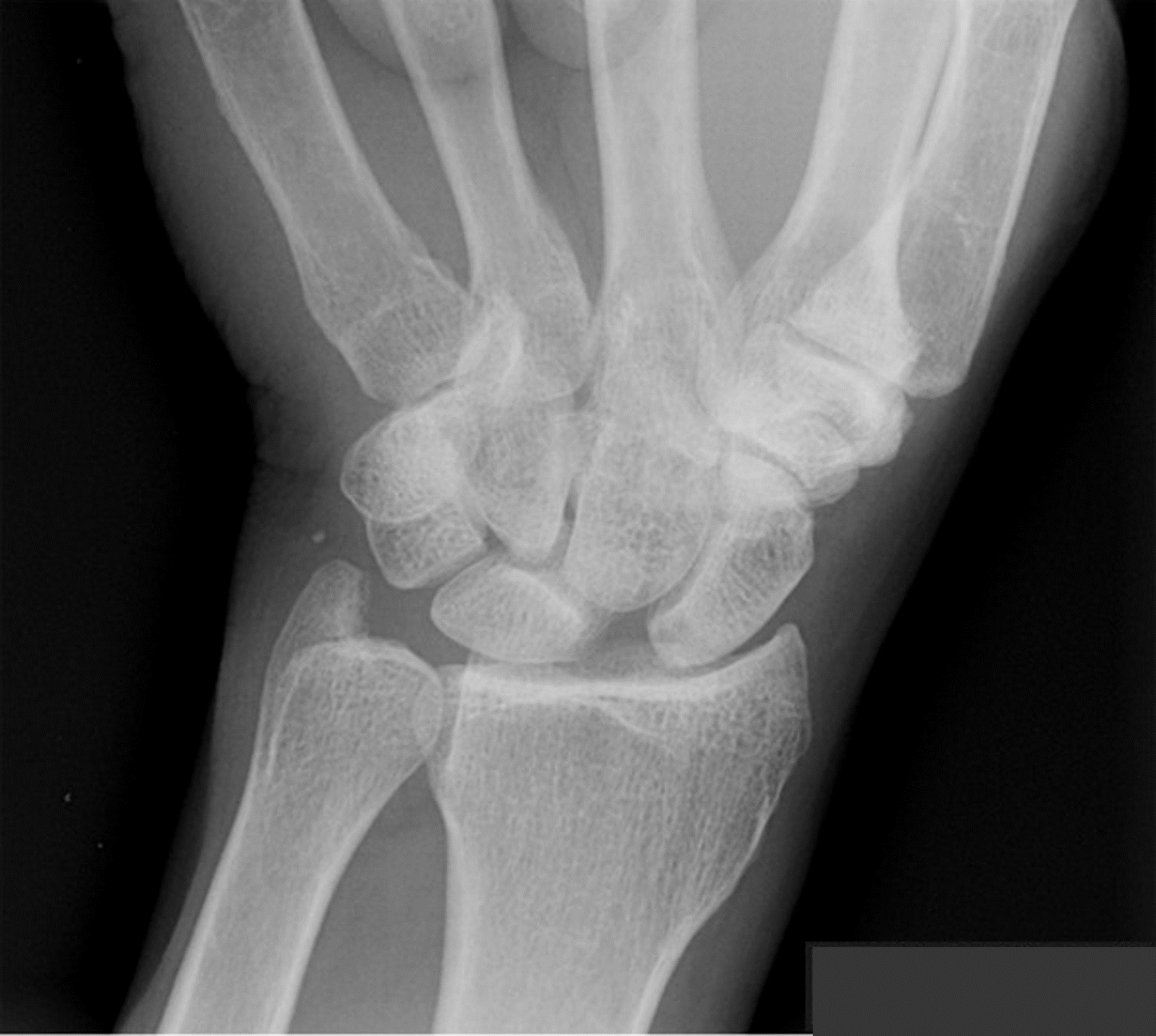 <p>What is the diagnosis?</p>