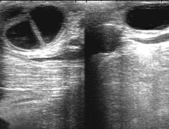 <p>How do you follow up on a bovine ovarian follicular cysts?</p>