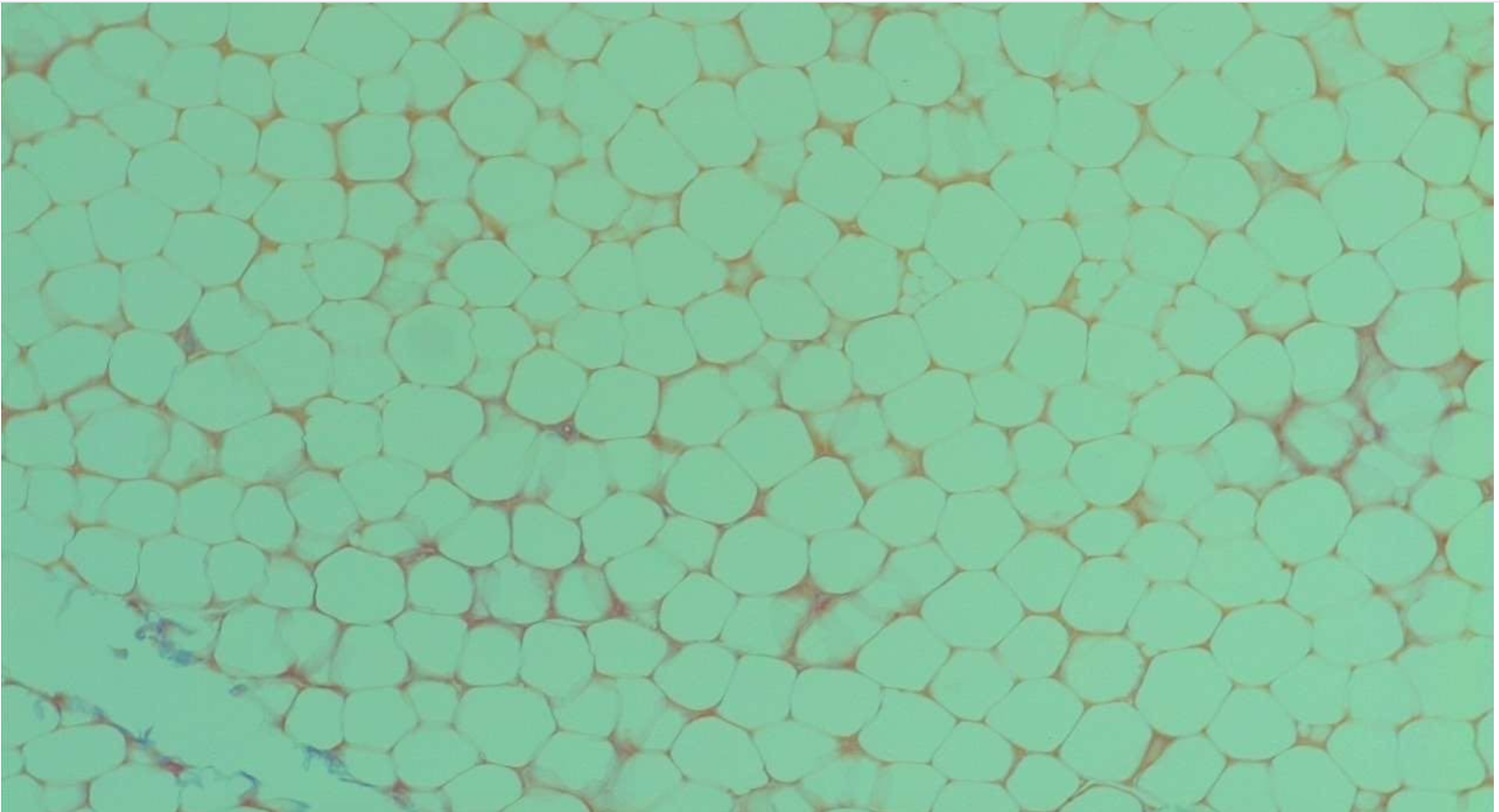 <p>Adipose Connective Tissue </p>