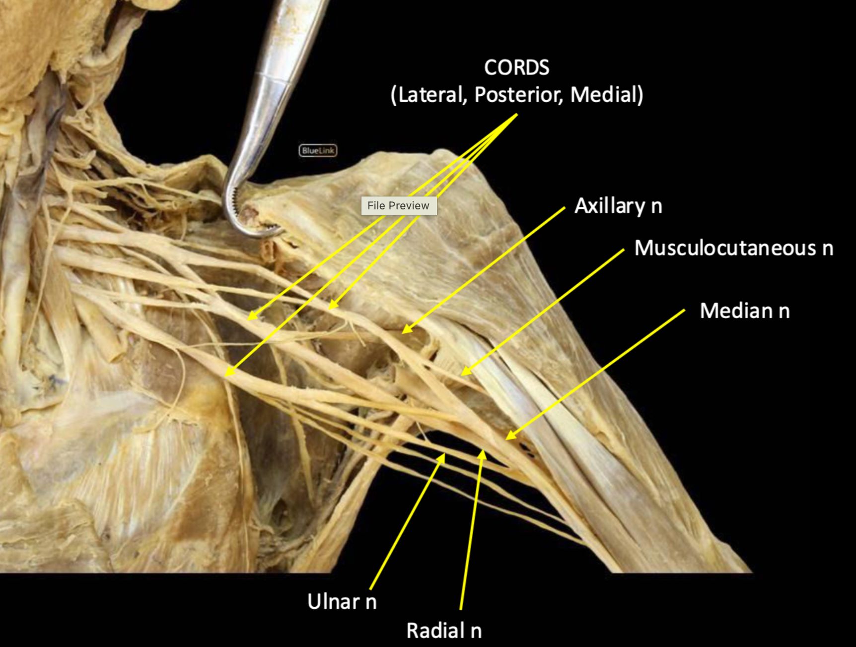 knowt flashcard image