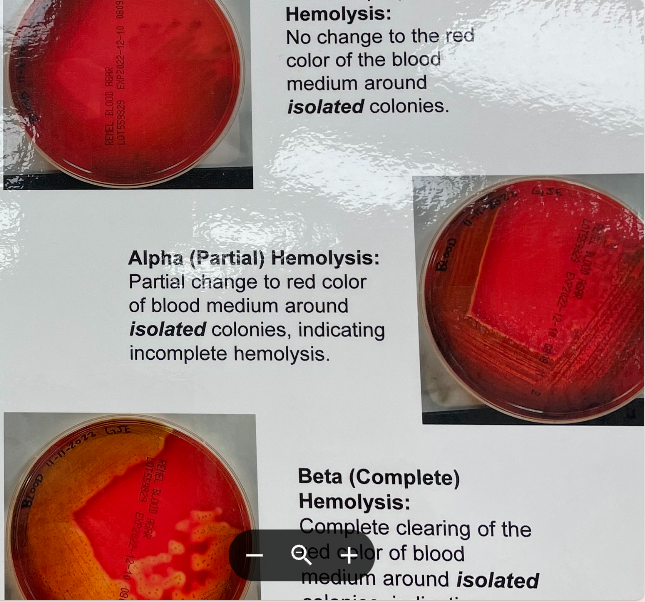 <p>Differential for types of hemolysis</p><ul><li><p>blood plates must be streaked for isolation, and hemolysis must be rad at isolated colonies by holding the plate up to the light and looking for changes to the medium and around isolated colonies</p></li></ul><p>Gamma (No) Hemolysis:</p><ul><li><p>No change to the red color of the blood medium around isolated colonies</p></li></ul><p>Alpha (Partial) Hemolysis:</p><ul><li><p>partial change to red color of blood medium around isolated colonies, indicating incomplete hemolysis</p></li></ul><p>Beta (Complete) Hemolysis</p><ul><li><p>complete clearing of the red color of blood medium around isolated colonies, indicating complete hemolysis</p></li></ul><p></p>