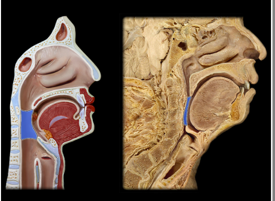 <p><span>Oropharynx</span></p>