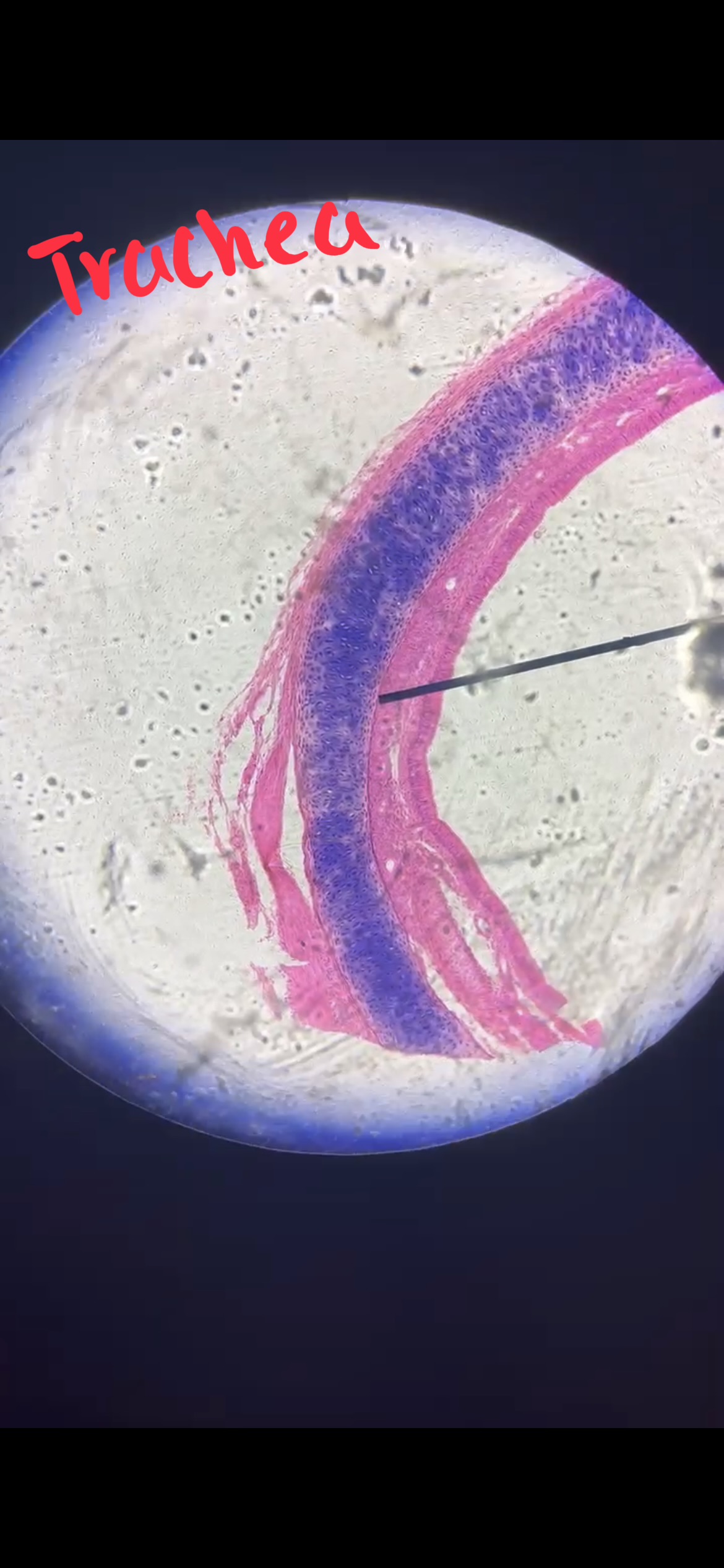 <p>Pseudostratified Columnar Epithelium Tissue ***</p>