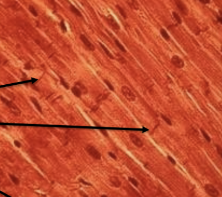 <p>Short, branched, uninucleate, involuntary, striated, INTERCALCATED DISKS (coordinate heart beat)</p>