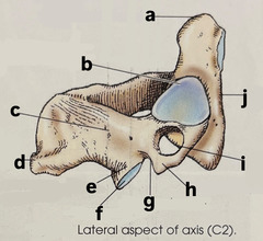 <p>label (a-c) lateral aspect of axis (C2)</p>