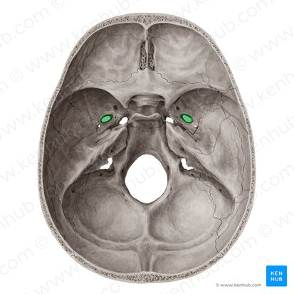 <p>sphenoid bone</p>