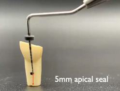 <p>For the parapost fiber post-clinical application, how much length do you need to preserve of your apical seal?</p>