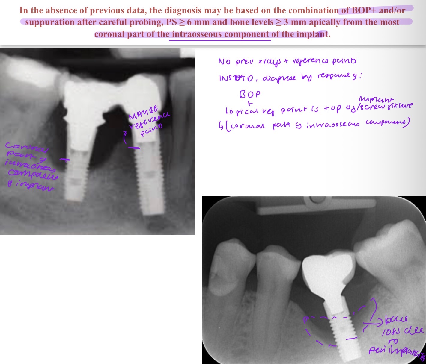 <p>Combo of BOP + and/or suppuration</p><p>PD 6mm or over, bone levels 3mm or over apical from most coronal intraossesous component of implant (logical reference point)</p>