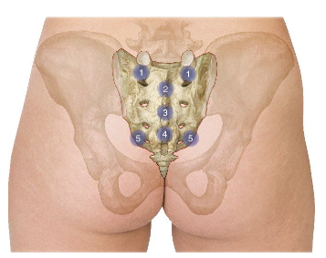 <p>sacral CS points?</p>