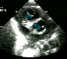 <p>Describe the findings of this image.</p>