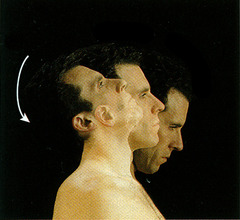 <p>extension beyond anatomical position</p>