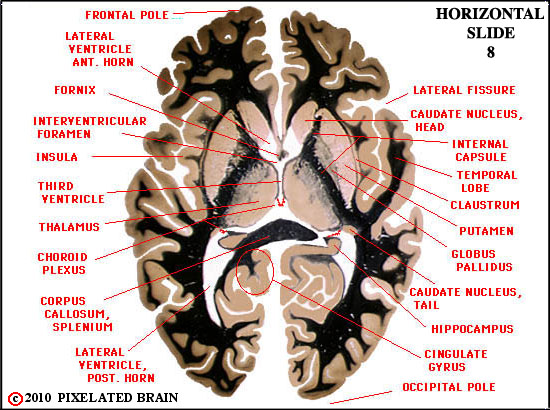 <p>Horizontal Plane</p>