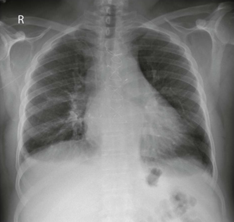 <p>AP Chest: Is this Image Good?</p>