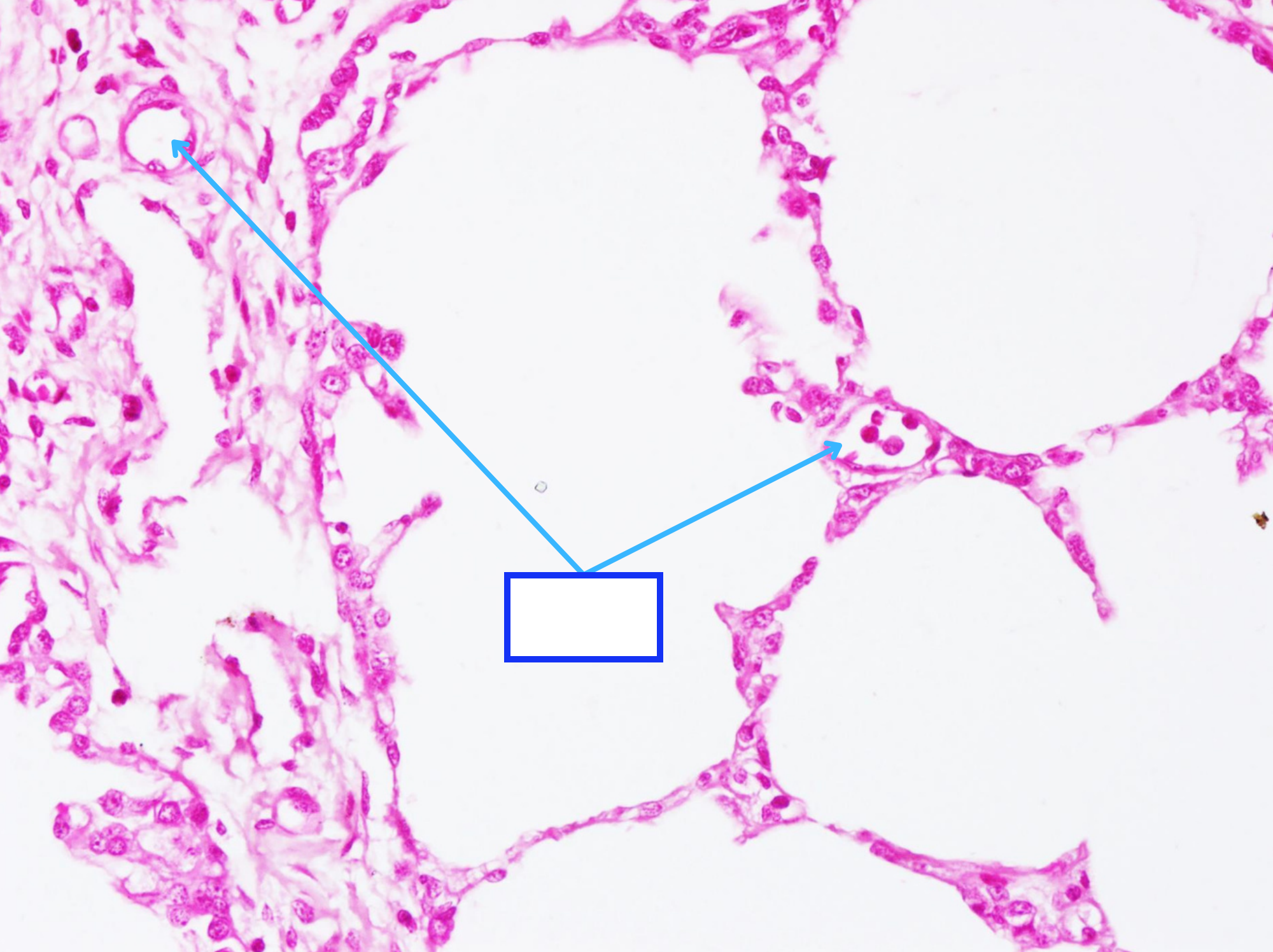 <p>Cấu trúc gì ?</p>