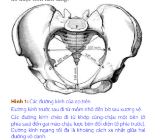 <p>Phía sau là mỏm nhô của xương cùng</p><p>2 bên là đường vô danh của xương chậu</p><p>Phía trước là bờ trên của khớp vệ</p>