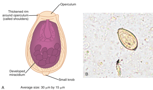 <p>Clonorchis sinesis, eggs (Phylum Platyhelminthes, Subphylum Neodermata, Class Trematoda, Subclass Digenea, Family Opisthorchidae). They are distinguished by their small size and the presence of a small knob at the abopercular end (the end opposite of the operculum).</p>
