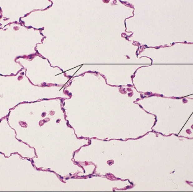 <p>what is the name of this tissue?</p>
