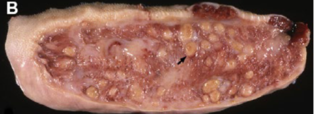 <p>Cross section of a tongue from a cow. What likely caused these lesions?</p>