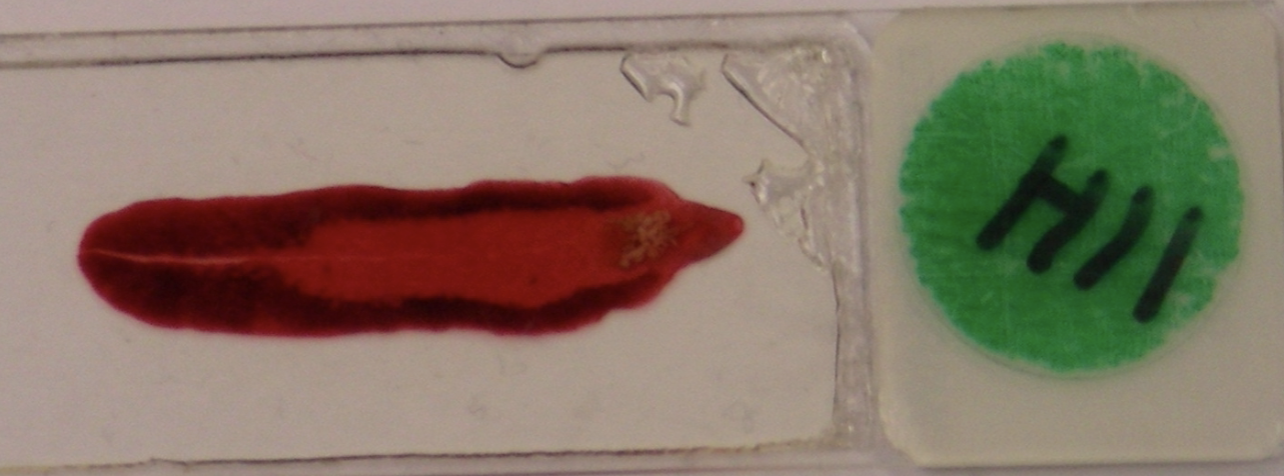 <p>What fluke is this?</p>