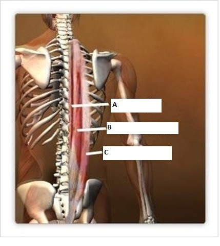<p>A</p>