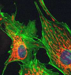 <p>Uses laser light to scan samples and create high-resolution images, often used for thick specimens.</p>