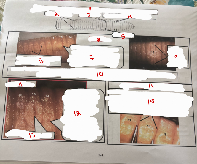 <p>Earthworm Ventral Side</p>
