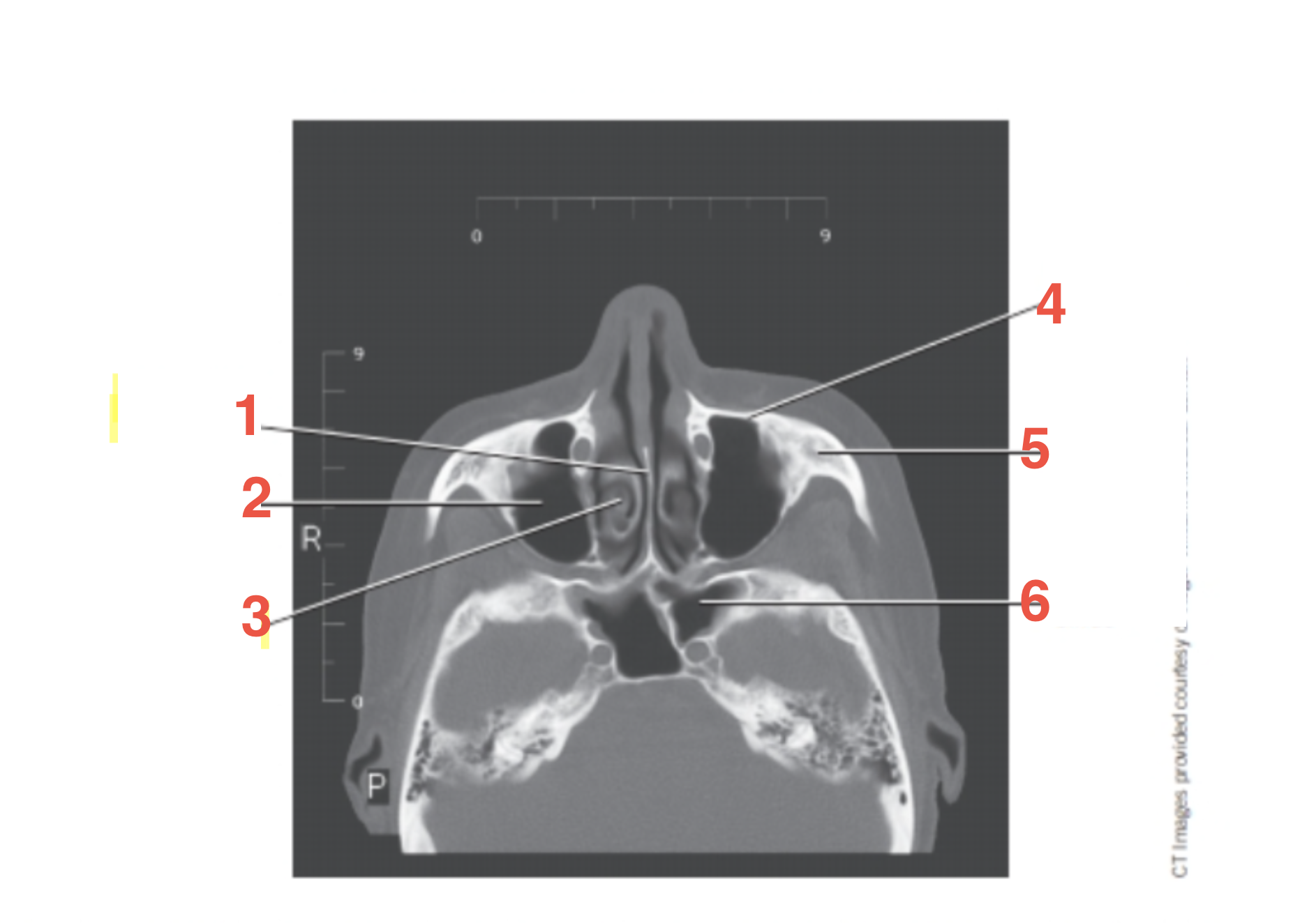 <p>4</p>