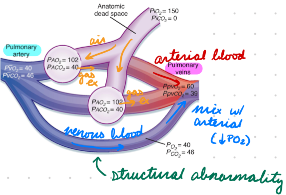 <p>From structural abnormalities</p><p>Venous blood bypass gas-exchange unit to mix with arterial blood</p><p>Low V, normal Q</p><ul><li><p>V/Q < 0.80</p></li></ul><p></p>