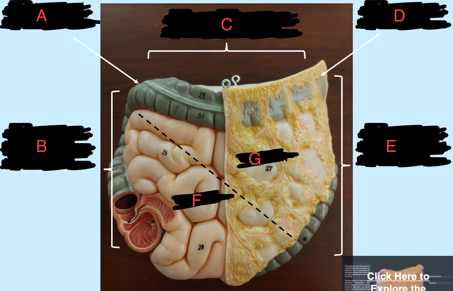<p>what’s labeled</p>
