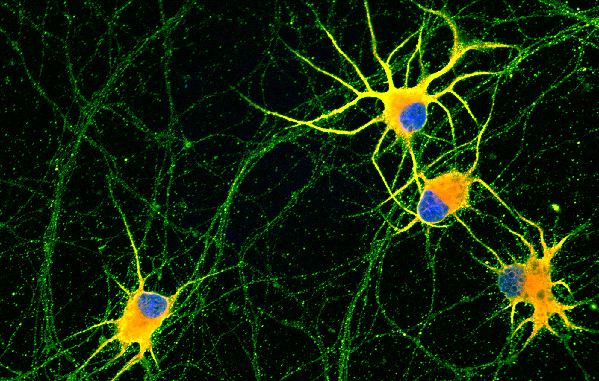 <p>a type of fluorescent microscope, living or dead tissue stained with fluorescent probes</p><p>- You can take 1uM thick ‘stacks’ or ‘zstacks’ of tissue</p><p>- You can ‘tile’ multiple tissue photos and stitch them together</p><p>- Produces more signal-to-noise ratio than the two-photon microscope</p>