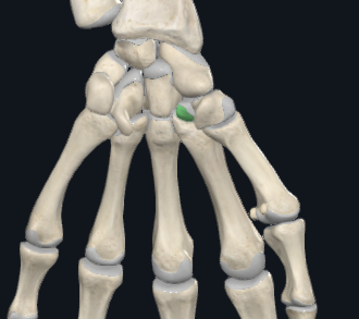 <p>what is this following bone and what section of the hand is it found in?</p>