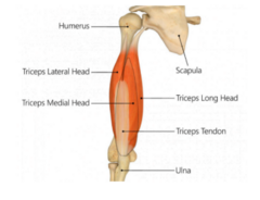 <p>shaft of humerus medial to radial groove</p>