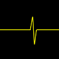 <p>- Sum of positive and negative end</p><p>- Electrodes are so close together most noise is measured equally</p><p>- Unaffected by FF signals</p><p>- Sees higher frequency</p>