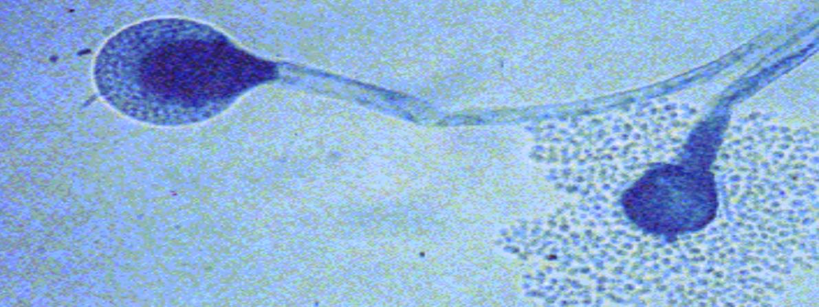 <p>Specimen (microscopically slide):</p><p>• Name of organism:</p><p>• Stain:</p><p>• Sample from: culture or pus or in tissue</p><p>• Morphology</p>