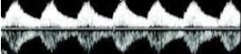 <p>crosstalk</p>