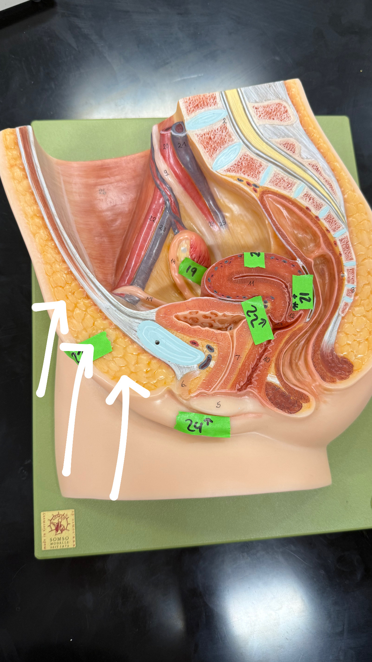 <p>fat surrounding the pubic bone, (blue)</p>