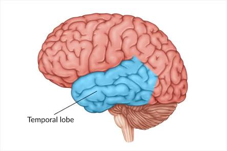 <p>Temporal lobe (lateral temporal cortex)</p>