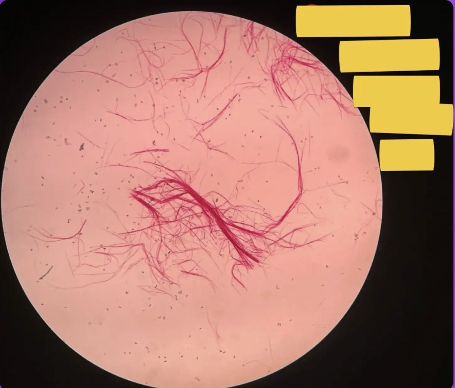 <p>What does the yellow box represent?</p>