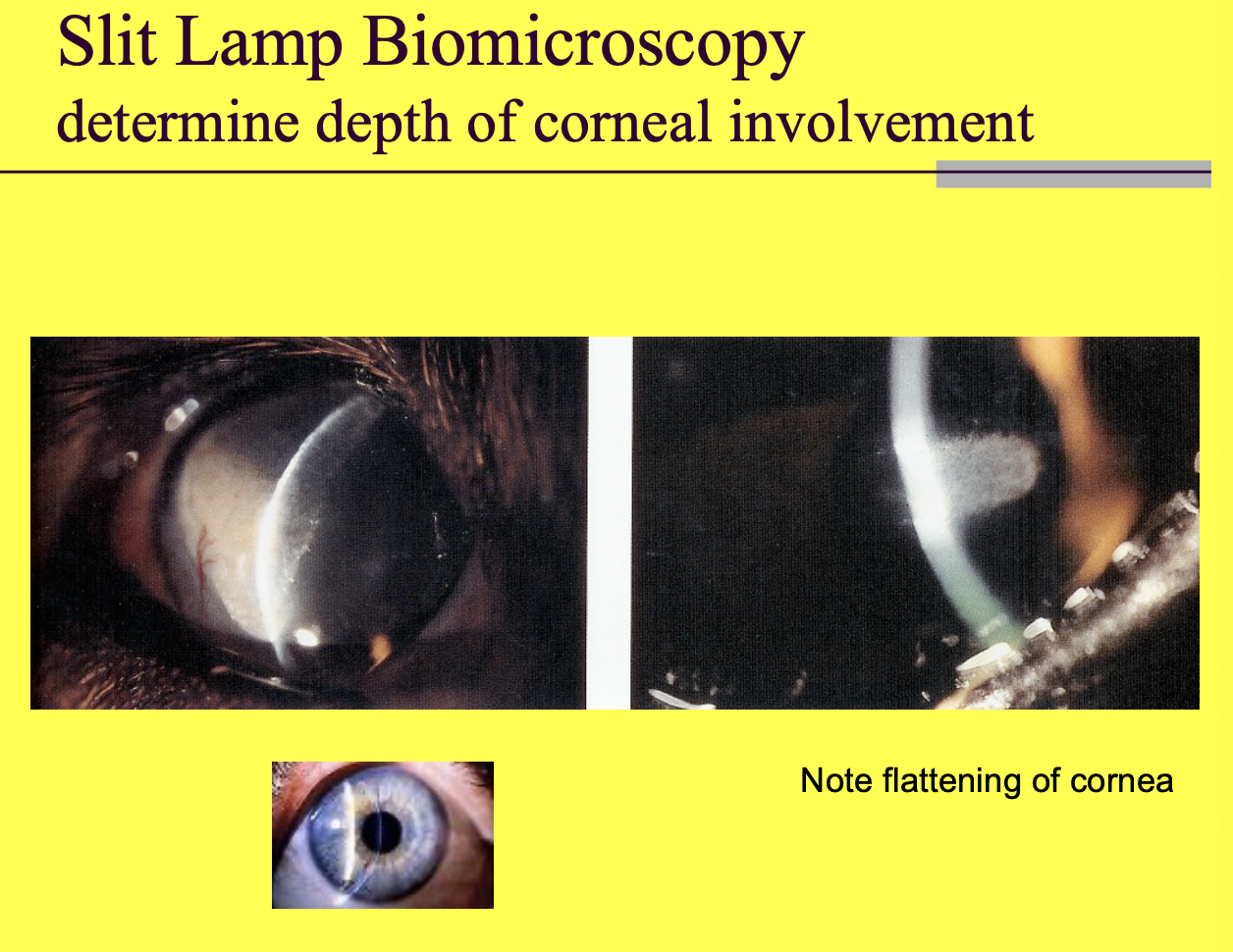 <p>slit lamp biomicroscopy.</p>