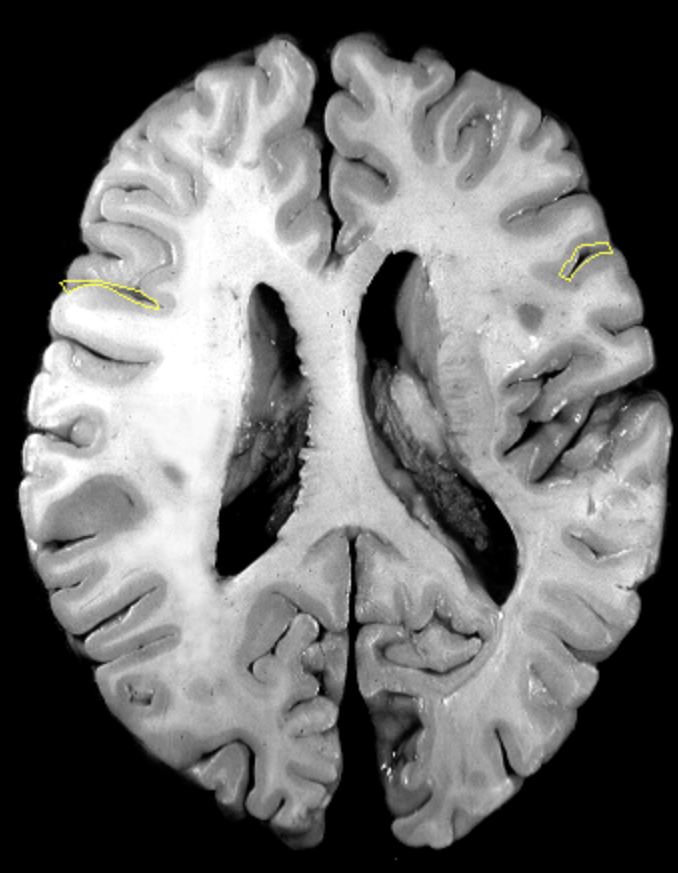 <p>What is the area highlighted called?</p>