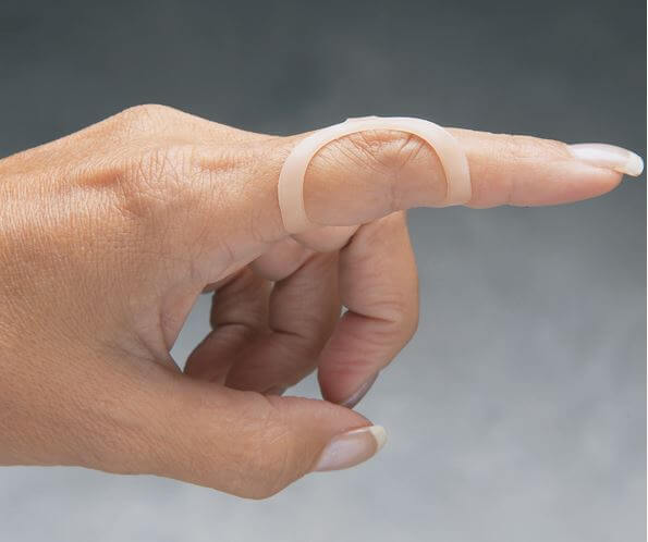 <p><span style="color: green;"><strong>Zone III/3</strong></span> Extensor Injury<strong> “Swan Neck” - Oval-8 ring splints manage this deformity by… </strong></p>