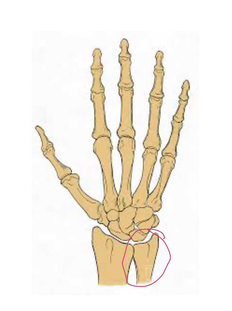 <p>Pinky side, looks like U</p>