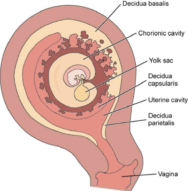 <p>Decidualized endometrium differentiates into 3 distinct areas:</p><ul><li><p><u>Decidua Basali</u>s: portion of thick decidua at implantation site, maternal portion, deepest layer of placenta</p></li><li><p><u>Decidua Capsularis</u>: Thin portion of endometrium, overlies section of gestational sac facing uterine cavity</p></li><li><p><u>Decidua Parietali</u>s: (decidua vera), remaining endometrium or peripheral portion, unoccupied by implanted ovum</p></li></ul><p>Decidua capsularis and parietalis are shed at parturition (birth)</p><p><u>Placenta serves as endocrine gland</u>: produces human chorionic gonadotropin-hCG- communicates to the body that gestation is present ; produces estrogen and progesterone throughout pregnancy</p><p><u>Placenta is Divided into</u>:</p><p>Chorionic Plate: Portion toward inside of sac that touches amniotic membrane</p><p>Base Plate/Basal layer: Portion on outside that touches uterus</p><p>Placental Substance: Placental material between basal layer and chorionic plate</p>