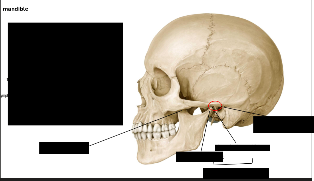 <p>Label the Mandiblee</p>