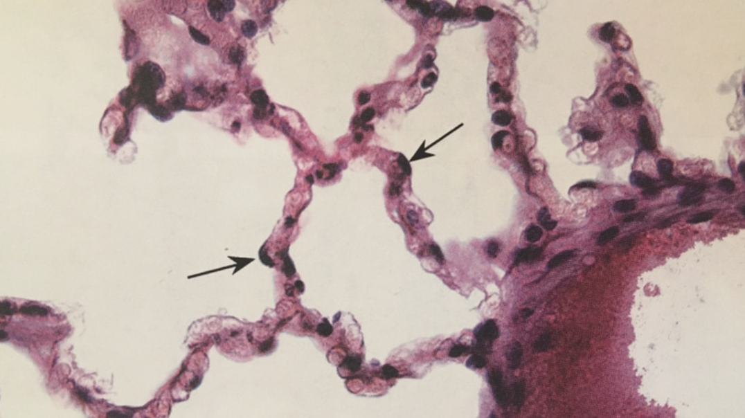 <p>Simple squamous epithelium </p>