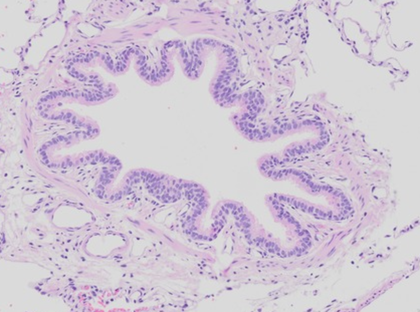 <p>Absence of cartilage and submucosal glands.</p>