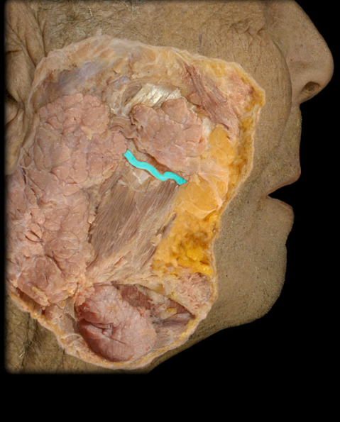 <p>passes over the masseter muscle, pierces the buccinator muscle and enters into the vestibule of the oral cavity opposite the second upper molar tooth</p>