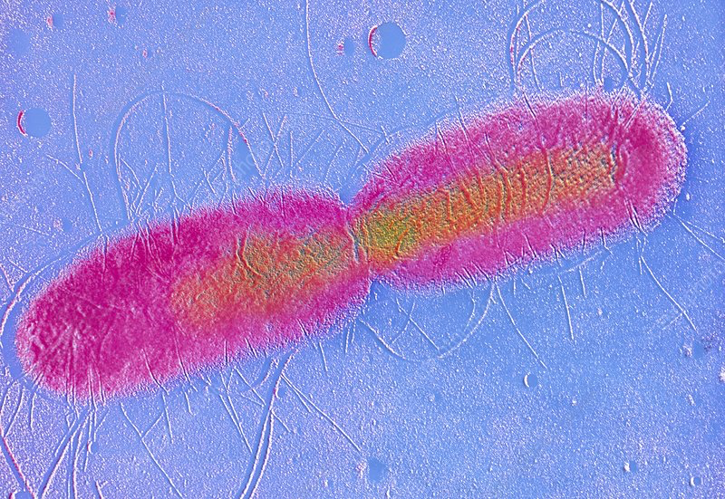<p>One cell splits into two identical daughter cells. <span data-name="girl" data-type="emoji">👧</span> <span data-name="girl" data-type="emoji">👧</span> !</p><p>Binary fission begins when the DNA of the bacterium doubles in quantity then divides into two (replicates) <span data-name="dna" data-type="emoji">🧬</span><strong>→</strong> <span data-name="dna" data-type="emoji">🧬</span></p><p>The bacterial cell then elongates and splits into two daughter cells, each with DNA that is identical to that of the parent cell </p>