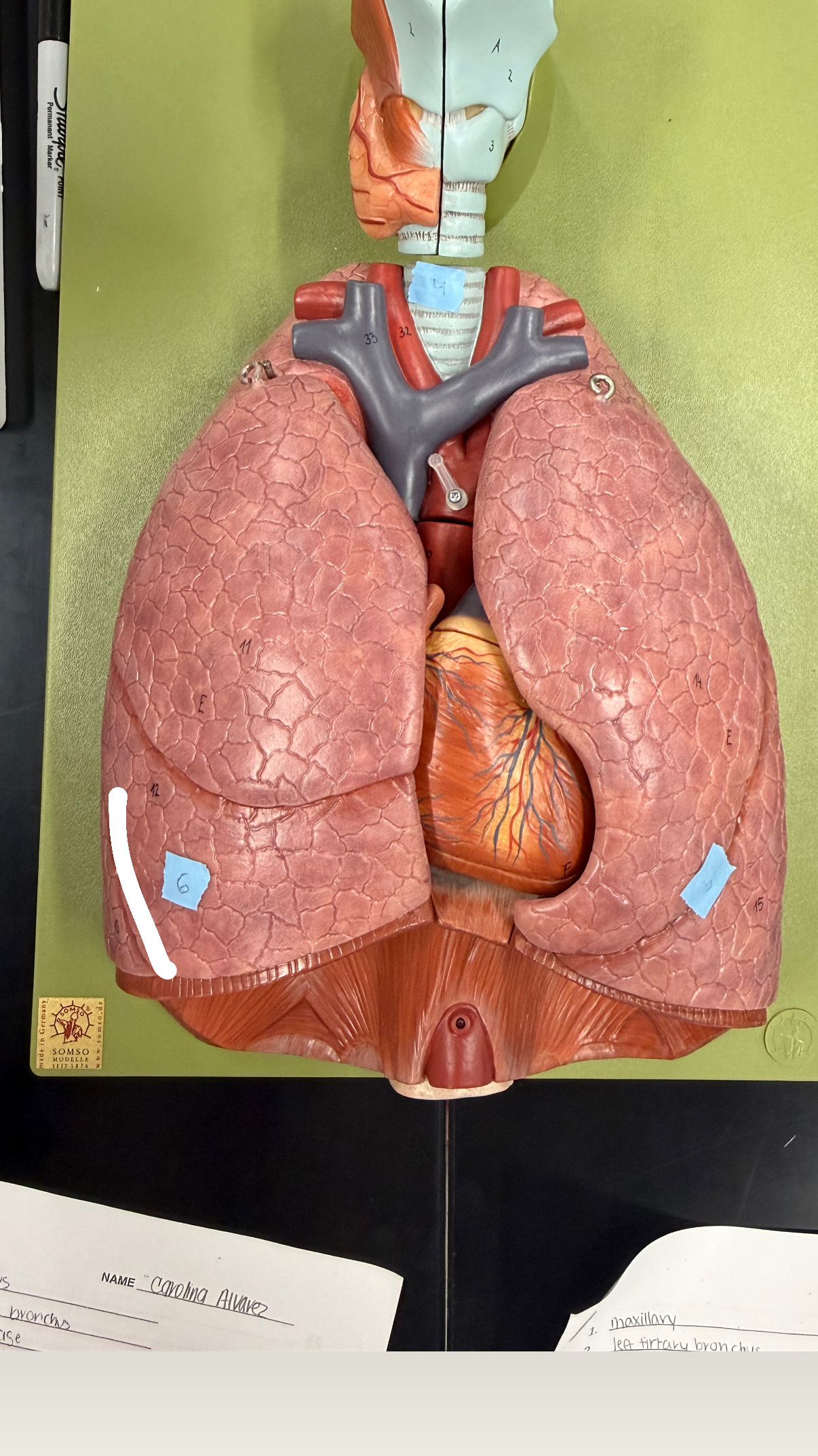 <p>seperating middle and inferior lobe (check right or left)</p>
