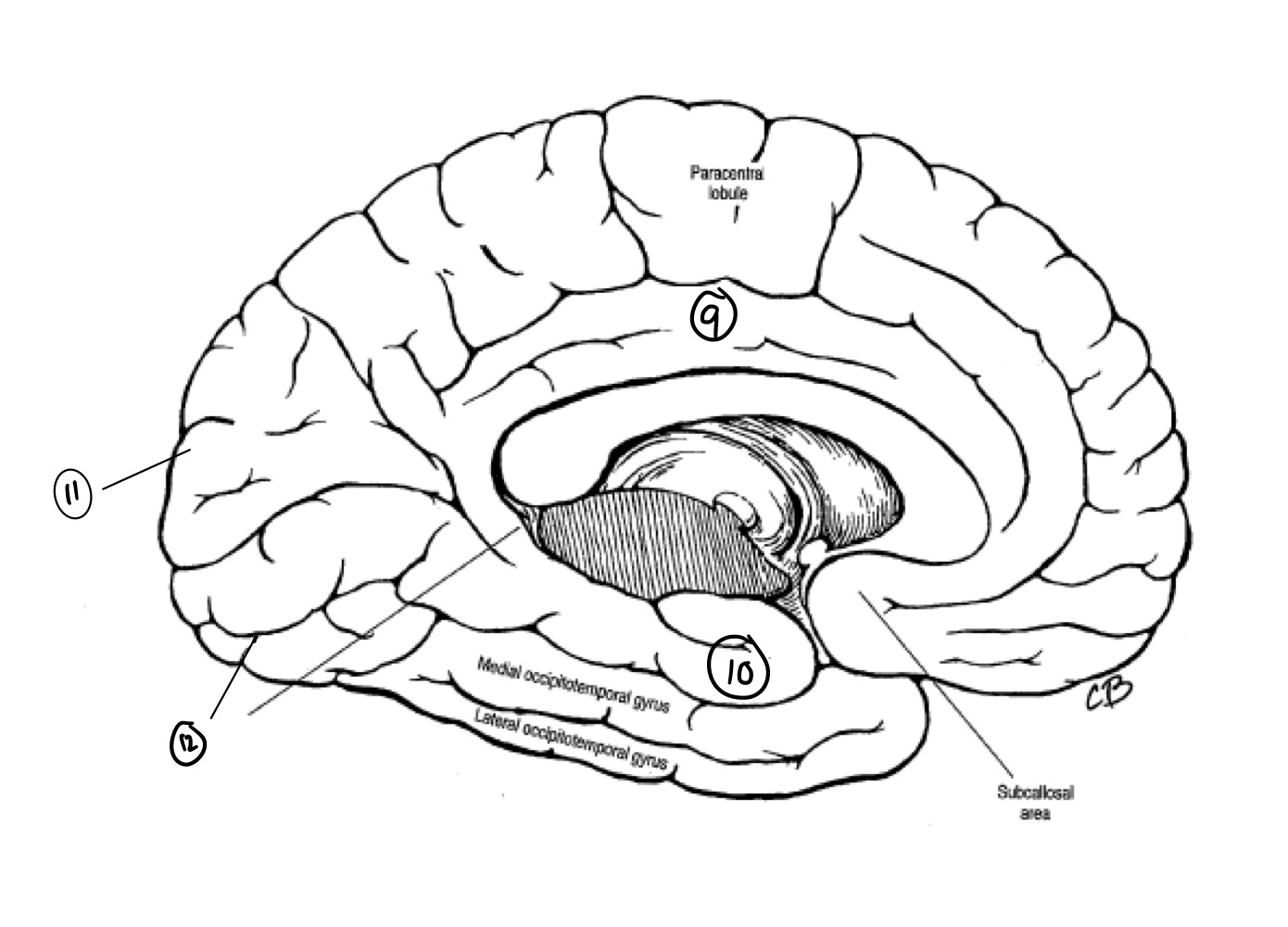 <p>What gyrus does #12 represent?</p>